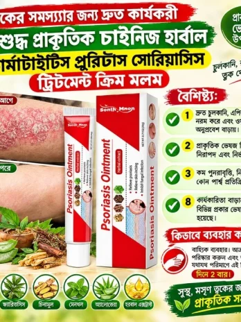 Psoriasis Ointment 20gm (সোরিয়াসিস ক্রিম)